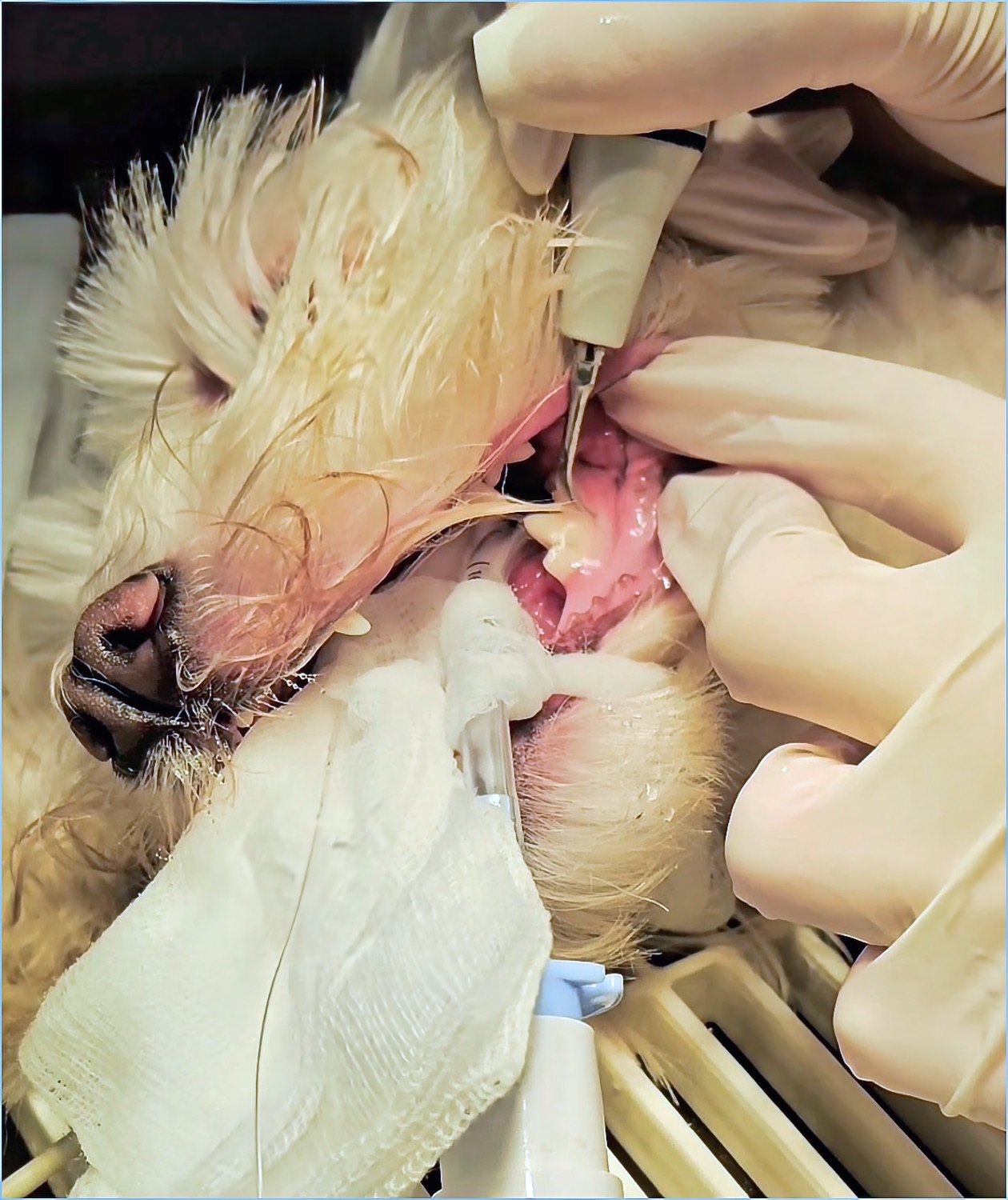 az íny alatti fogkövet is leszedjük