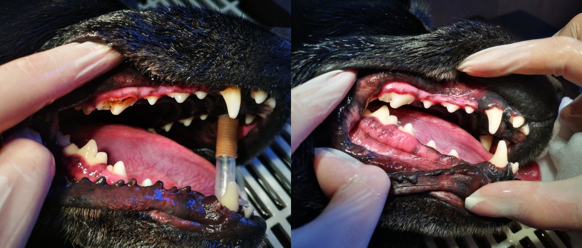 fogkőelválotítás előtt és után