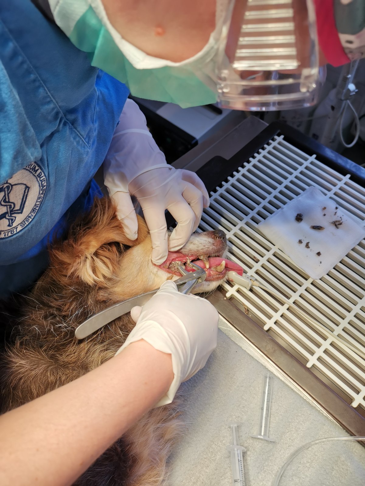 fogkő és fogeltávolítás