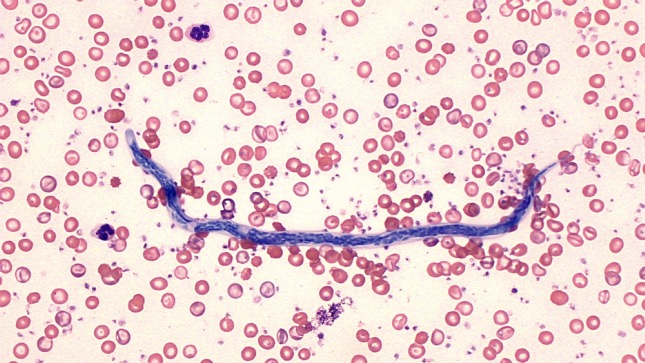 Szivfereg antibiotikum, A kutyák szívférgessége